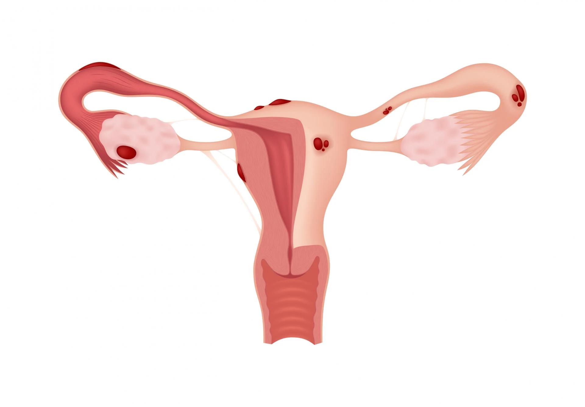 신체 컨디션과 생리통, 연관이 있을까? — 차차여성의원 내몸이야기 이미지 4